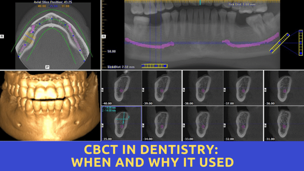 CBCT in Dentistry: When and Why it Used
